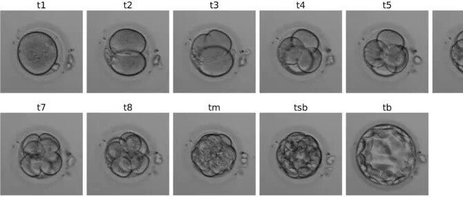 深度学习助力 IVF：精准识别胚胎发育关键事件